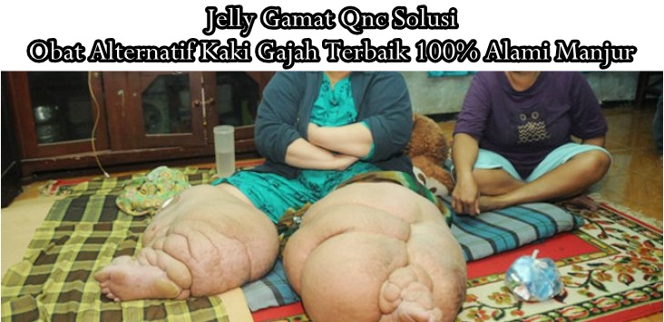 Obat Alternatif Kaki Gajah Terbaik 100% Alami Manjur
