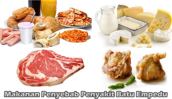 Makanan Penyebab Penyakit Batu Empedu