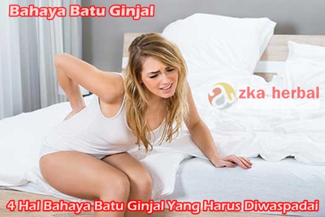 4 Hal Bahaya Batu Ginjal Yang Harus Diwaspadai