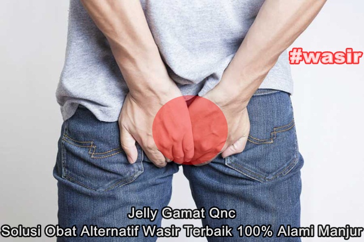 Obat Alternatif Wasir Terbaik 100% Alami Manjur